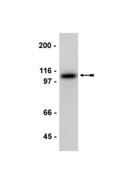 Anti-E-Cadherin Antibody serum, Upstate&#174;