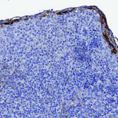 Anti-ATP12A antibody produced in rabbit Prestige Antibodies® Powered by Atlas Antibodies, affinity isolated antibody, buffered aqueous glycerol solution