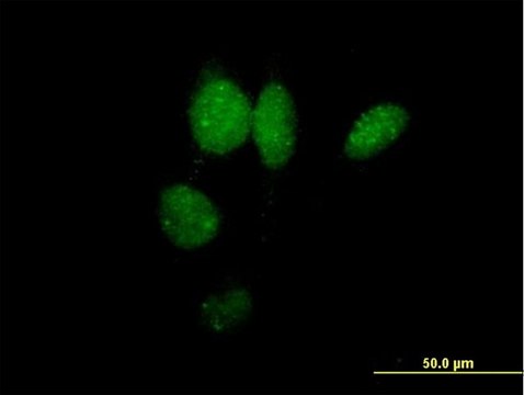 Anti-IRF2 antibody produced in mouse purified immunoglobulin, buffered aqueous solution