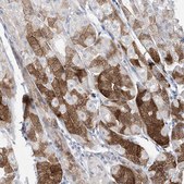 Anti-ASNS antibody produced in rabbit Prestige Antibodies® Powered by Atlas Antibodies, affinity isolated antibody, buffered aqueous glycerol solution