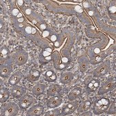 Anti-SH3BP5L antibody produced in rabbit Prestige Antibodies® Powered by Atlas Antibodies, affinity isolated antibody, buffered aqueous glycerol solution