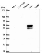 Anti-ACSM2A antibody produced in rabbit Prestige Antibodies® Powered by Atlas Antibodies, affinity isolated antibody, buffered aqueous glycerol solution