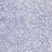 Anti-ZDHHC4 antibody produced in rabbit Prestige Antibodies® Powered by Atlas Antibodies, affinity isolated antibody, buffered aqueous glycerol solution