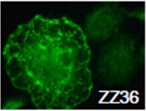 Anti-WASF2/WAVE-2 Antibody, clone ZZ36-12 clone ZZ36-12, from mouse, purified by affinity chromatography