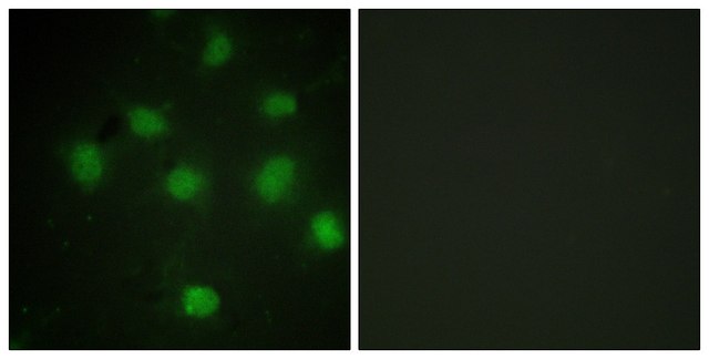 Anti-TLK1 antibody produced in rabbit affinity isolated antibody