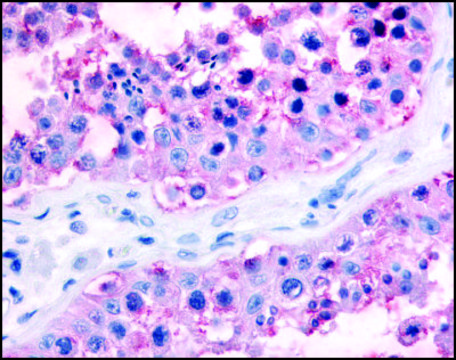 Anti-GJA1 antibody produced in rabbit affinity isolated antibody, buffered aqueous solution