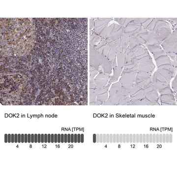 Anti-DOK2 Prestige Antibodies&#174; Powered by Atlas Antibodies, affinity isolated antibody