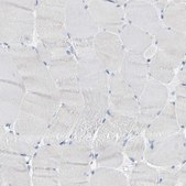 Anti-KLK5 antibody produced in rabbit Prestige Antibodies® Powered by Atlas Antibodies, affinity isolated antibody, buffered aqueous glycerol solution