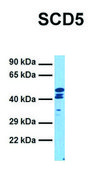 Anti-SCD5 (C-terminal) antibody produced in rabbit affinity isolated antibody