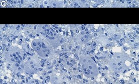 Anti-Histone H3.3 G34W Antibody, clone 2E20 ZooMAb® Rabbit Monoclonal recombinant, expressed in HEK 293 cells