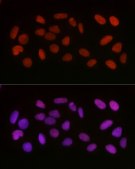 Anti- Acetyl-HMGB1-K29 antibody produced in rabbit