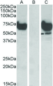 Anti-EPM2AIP1 antibody produced in goat affinity isolated antibody, buffered aqueous solution