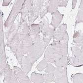 Anti-GP2 antibody produced in rabbit Prestige Antibodies® Powered by Atlas Antibodies, affinity isolated antibody, buffered aqueous glycerol solution