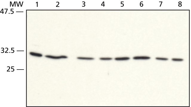 Anti-RACK1 (C-terminal) antibody produced in rabbit ~1&#160;mg/mL, affinity isolated antibody, buffered aqueous solution, immunoprecipitation: 5 &#956;g