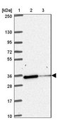 Anti-NIPSNAP1 antibody produced in rabbit Prestige Antibodies® Powered by Atlas Antibodies, affinity isolated antibody, buffered aqueous glycerol solution