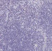 Anti-LAMC3 antibody produced in rabbit Prestige Antibodies® Powered by Atlas Antibodies, affinity isolated antibody, buffered aqueous glycerol solution