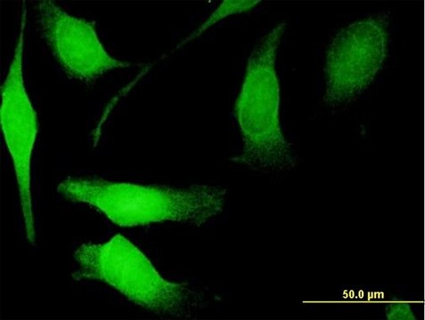 Anti-NGFRAP1 antibody produced in mouse purified immunoglobulin, buffered aqueous solution