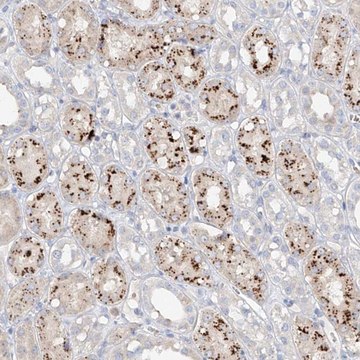 Anti-TRIM47 antibody produced in rabbit Prestige Antibodies&#174; Powered by Atlas Antibodies, affinity isolated antibody, buffered aqueous glycerol solution