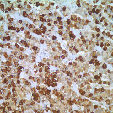 LH Rabbit Polyclonal Antibody