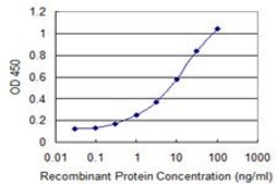 Monoclonal Anti-MLC1SA antibody produced in mouse clone 4G11, purified immunoglobulin, buffered aqueous solution