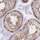 Anti-TOMM34 antibody produced in rabbit Prestige Antibodies® Powered by Atlas Antibodies, affinity isolated antibody, buffered aqueous glycerol solution