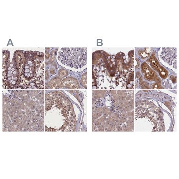 Anti-NUBP1 antibody produced in rabbit Prestige Antibodies&#174; Powered by Atlas Antibodies, affinity isolated antibody, buffered aqueous glycerol solution