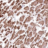 Anti-HADHB antibody produced in rabbit Prestige Antibodies® Powered by Atlas Antibodies, affinity isolated antibody, buffered aqueous glycerol solution