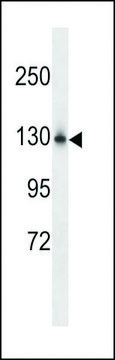 ANTI-NCKPL (CENTER) antibody produced in rabbit affinity isolated antibody, buffered aqueous solution