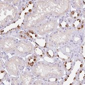 Anti-ATP6V1G3 antibody produced in rabbit Prestige Antibodies® Powered by Atlas Antibodies, affinity isolated antibody, buffered aqueous glycerol solution
