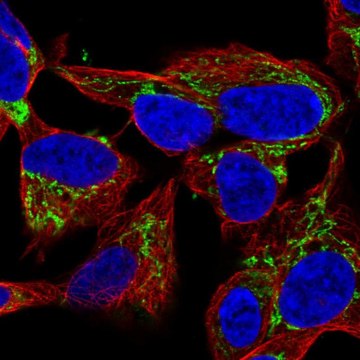 Anti-NME4 antibody produced in rabbit Prestige Antibodies&#174; Powered by Atlas Antibodies, affinity isolated antibody