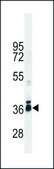 ANTI-STRA8 (C-TERM) antibody produced in rabbit IgG fraction of antiserum, buffered aqueous solution