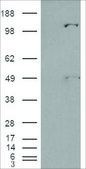 Anti-Pyruvate Carboxylase antibody produced in goat affinity isolated antibody, buffered aqueous solution