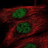 Anti-TBK1 antibody produced in rabbit Prestige Antibodies® Powered by Atlas Antibodies, affinity isolated antibody, buffered aqueous glycerol solution