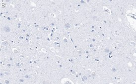 Anti-PSD-95 Antibody, clone 2B20 ZooMAb® Rabbit Monoclonal recombinant, expressed in HEK 293 cells
