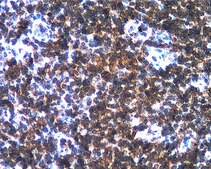 Anti-IL-18 Antibody, clone 12E7.1 clone 12E7.1, from mouse