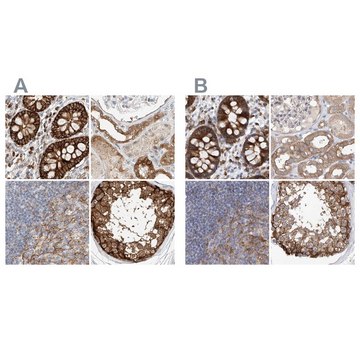 Anti-CARMIL1 antibody produced in rabbit Prestige Antibodies&#174; Powered by Atlas Antibodies, affinity isolated antibody, buffered aqueous glycerol solution, ab2