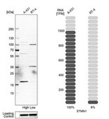 Anti-STMN1 antibody produced in rabbit Prestige Antibodies® Powered by Atlas Antibodies, affinity isolated antibody, buffered aqueous glycerol solution