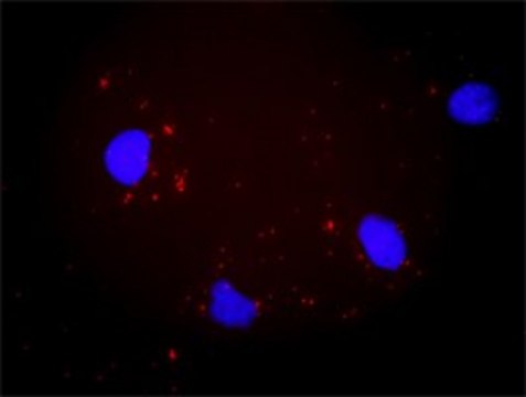 Anti-ITGAV antibody produced in mouse purified immunoglobulin, buffered aqueous solution