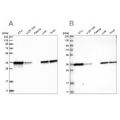 Anti-PDXK antibody produced in rabbit Prestige Antibodies® Powered by Atlas Antibodies, affinity isolated antibody, buffered aqueous glycerol solution