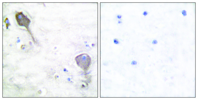 Anti-Parkin antibody produced in rabbit affinity isolated antibody