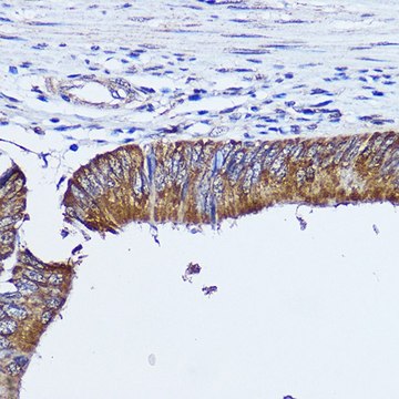 Anti- RhoA antibody produced in rabbit