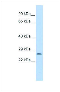 Anti-GATAD1 antibody produced in rabbit affinity isolated antibody