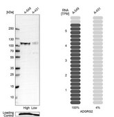 Anti-ADGRG2 antibody produced in rabbit Prestige Antibodies® Powered by Atlas Antibodies, affinity isolated antibody