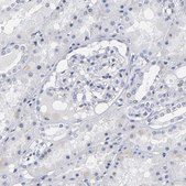 Anti-RPH3A antibody produced in rabbit Prestige Antibodies® Powered by Atlas Antibodies, affinity isolated antibody, buffered aqueous glycerol solution