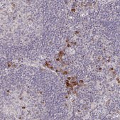 Anti-MEIS1 antibody produced in rabbit Prestige Antibodies® Powered by Atlas Antibodies, affinity isolated antibody, buffered aqueous glycerol solution