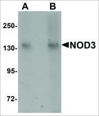 Anti-NOD3 antibody produced in rabbit affinity isolated antibody, buffered aqueous solution