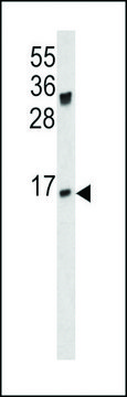 ANTI-IGJ(N-TERMINAL) antibody produced in rabbit purified immunoglobulin, buffered aqueous solution