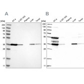 Anti-TP53I3 antibody produced in rabbit Prestige Antibodies® Powered by Atlas Antibodies, affinity isolated antibody, buffered aqueous glycerol solution