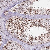 Anti-KPNA4 antibody produced in rabbit Prestige Antibodies® Powered by Atlas Antibodies, affinity isolated antibody, buffered aqueous glycerol solution