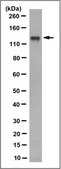 Anti-BICC1/Protein Bicaudal C Homolog 1 Antibody, clone 2D9.1 clone 2D9.1, from mouse